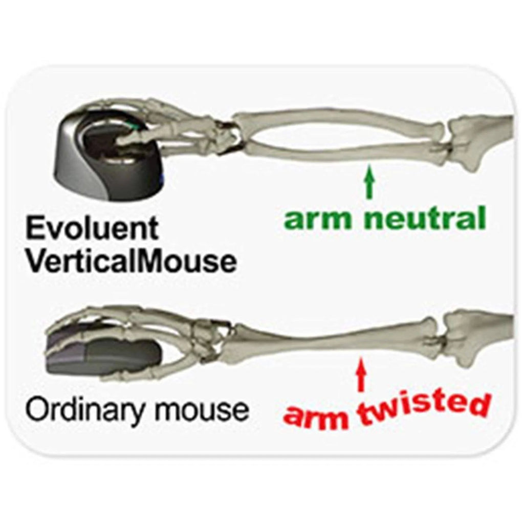 Vertical Mouse Right Handed D880782