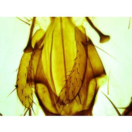 40X-2000X Binocular Lab Compound Microscope with Mechanical Stage E317